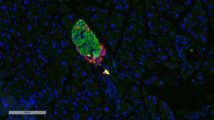 The image depicts morphologies of pancreatic islets. Sections were stained with antibodies to insulin (red), glucagon (yellow) and somatostatin (green), while the DNA was stained with DAPI (blue).